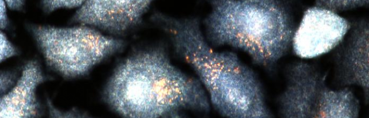 Nanoparticelle d'oro all'interno di cellule