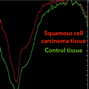 Mean Spectral Differences Between Cancerous and Non-Cancerous Tissue 